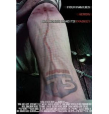 75 (2017)